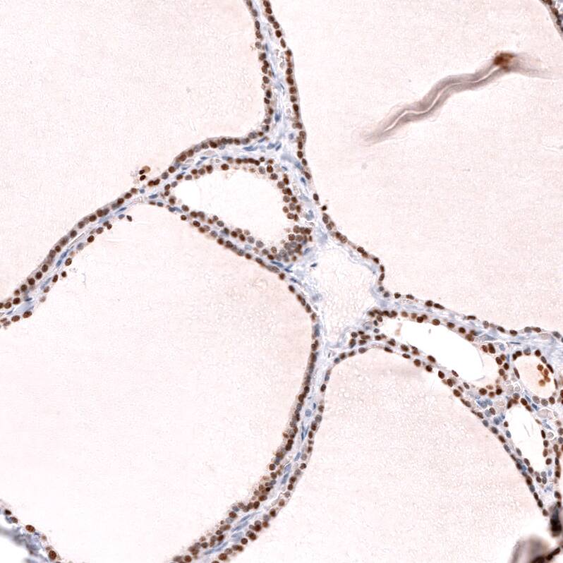 Staining of human thyroid gland shows strong nuclear positivity in glandular cells.