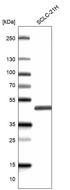 Analysis in human cell line SCLC-21H.