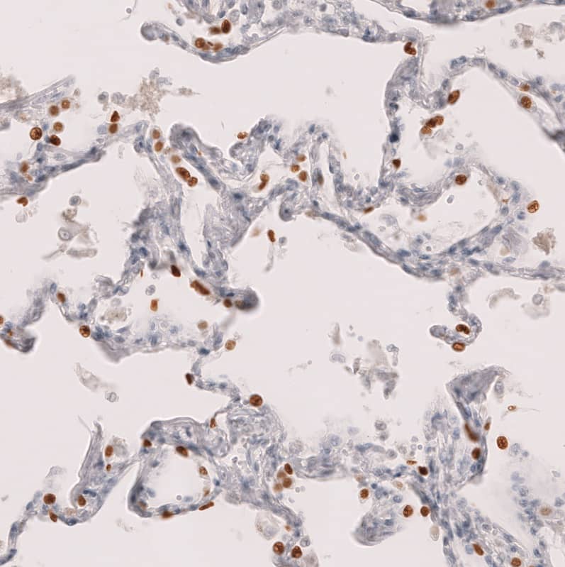 Staining of human lung shows strong nuclear positivity in a subset of pneumocytes.