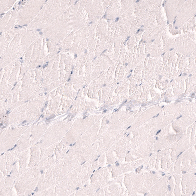 Staining of human skeletal muscle shows no positivity in myocytes as expected.