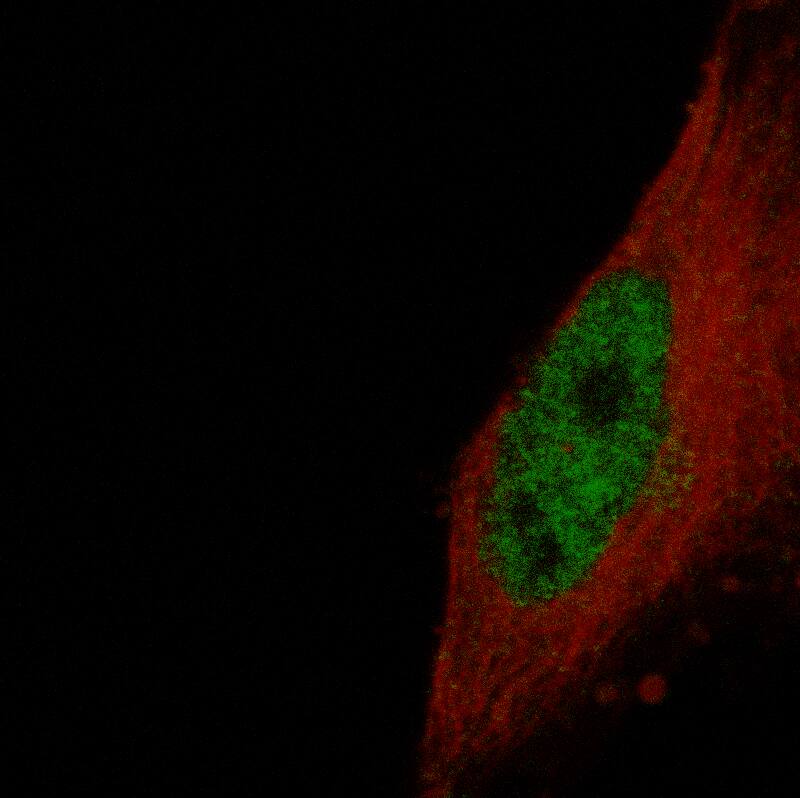 Staining in U-251MG cell line with Anti-ETV1 monoclonal antibody, showing specific staining of nucleoplasm in green. Microtubule- and nuclear probes are visualized in red and blue respectively (where available).