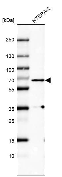 Analysis in human cell line NTERA-2.
