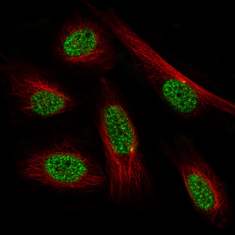 Staining in U-138MG cell line with Anti-PRRX1 monoclonal antibody, showing specific staining of nucleoplasm in green. Microtubule- and nuclear probes are visualized in red and blue respectively (where available).