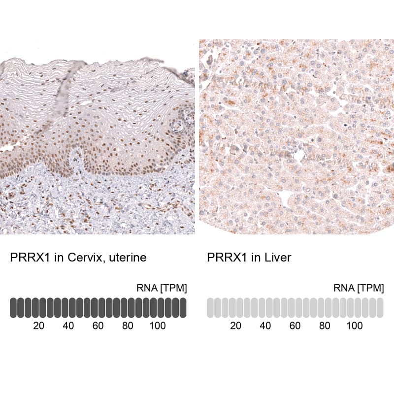 <b>Orthogonal Strategies Validation. </b>Analysis in human cervix, uterine and liver tissues using NBP3-44310 antibody. Corresponding PRRX1 RNA-seq data are presented for the same tissues.