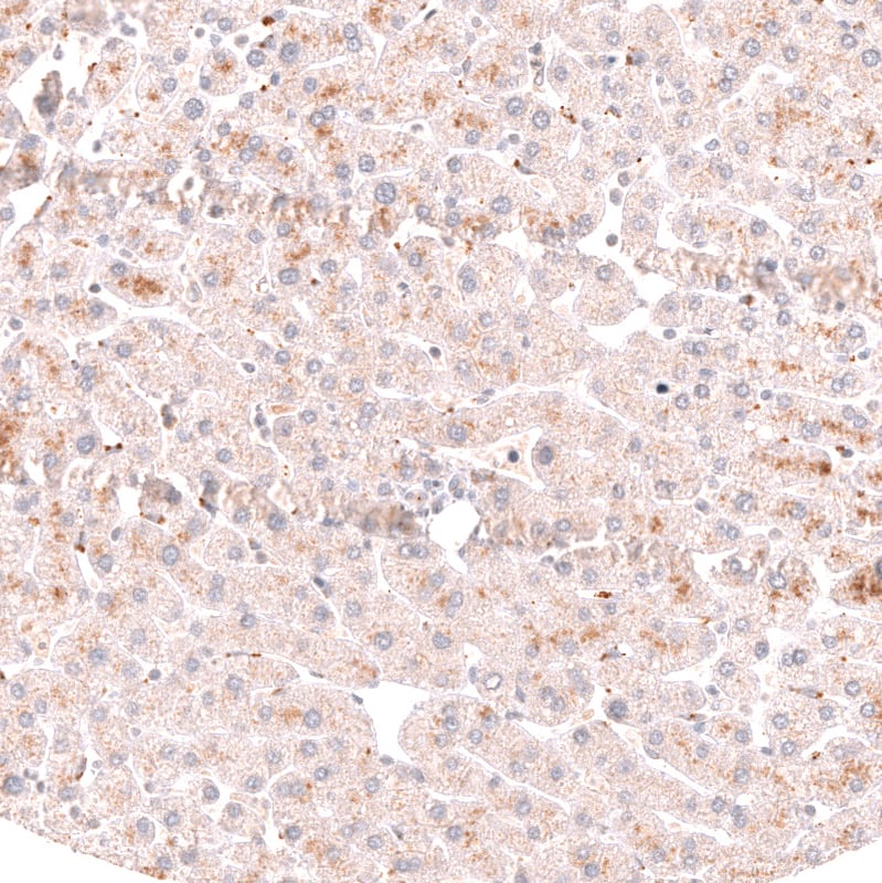 Staining of human liver shows no nuclear positivity in hepatocytes as expected.