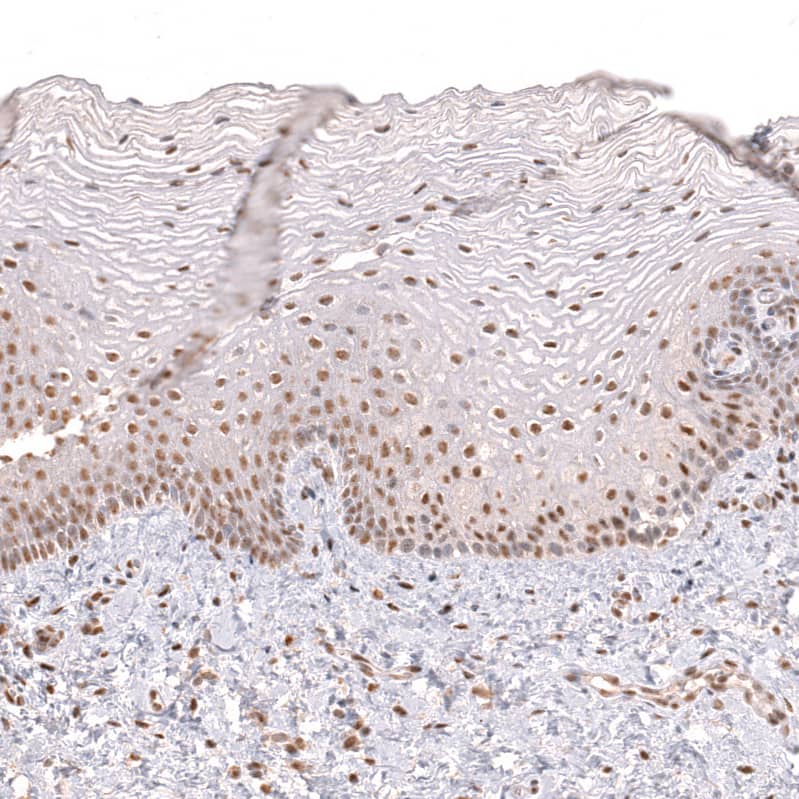 Staining of human uterine cervix shows strong nuclear positivity in squamous epithelial cells.