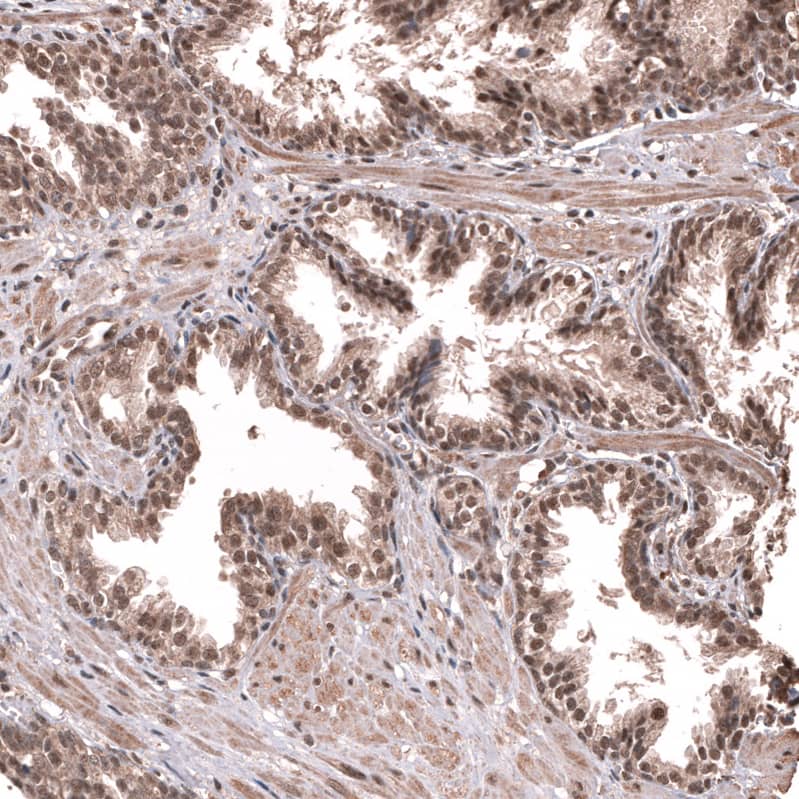 Staining of human prostate shows strong nuclear positivity in glandular cells.