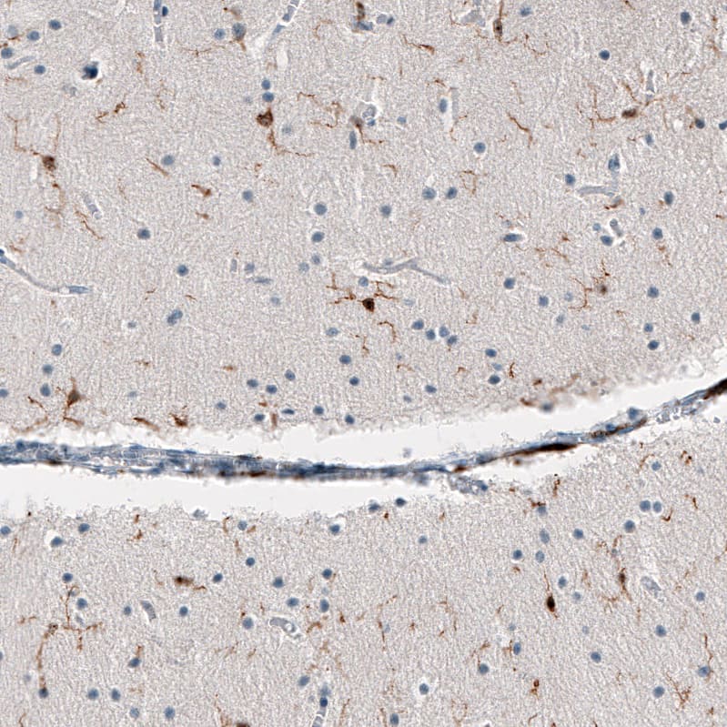 Staining of human cerebellum shows moderate cytoplasmic positivity in microglia.