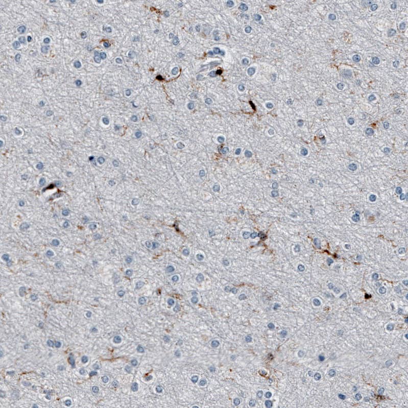 Staining of human cerebral cortex shows  moderate cytoplasmic positivity in microglia.