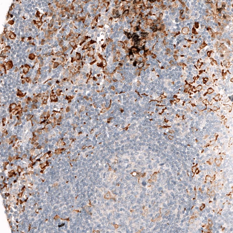 Staining of human lymph node shows strong cytoplasmic positivity in non-germinal center cells.