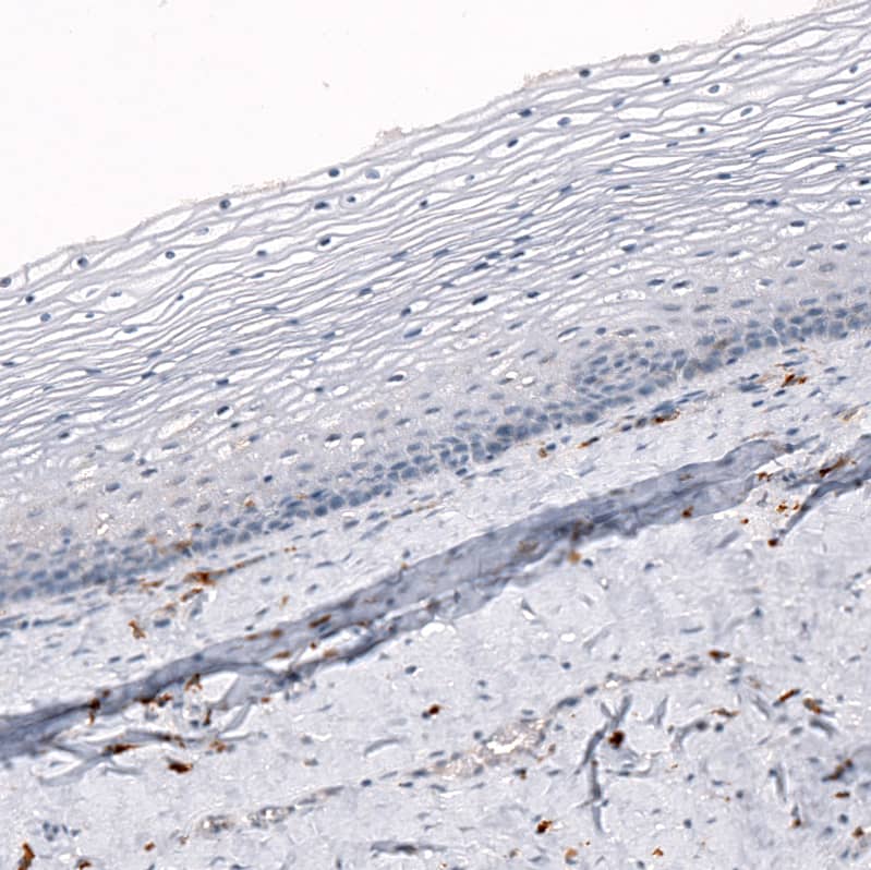 Staining of human uterine cervix shows no positivity in squamous epithelial cells as expected.
