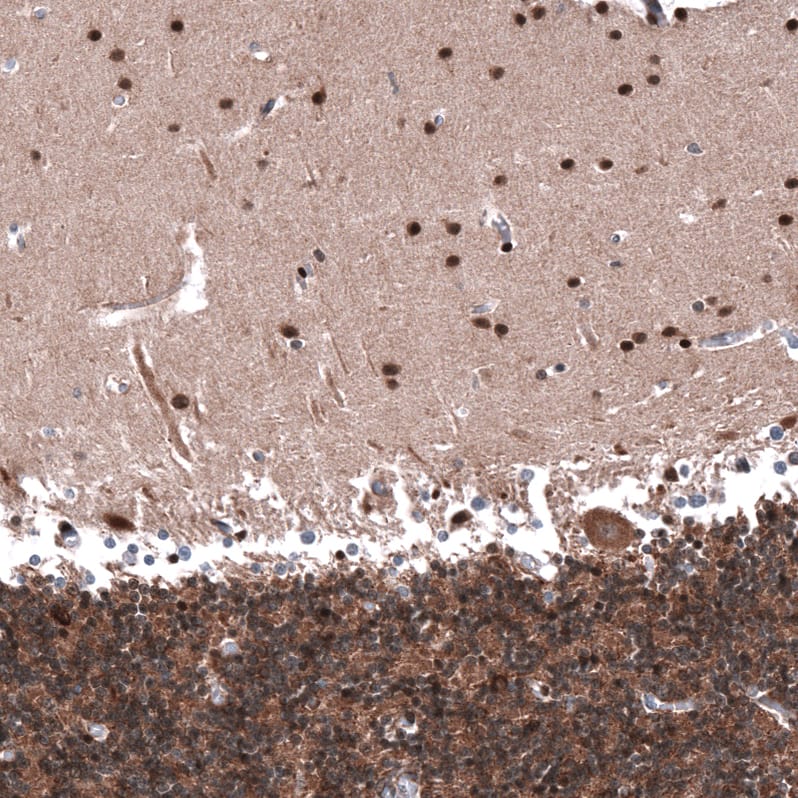 Staining of human cerebellum shows strong nuclear positivity in cells in molecular layer.