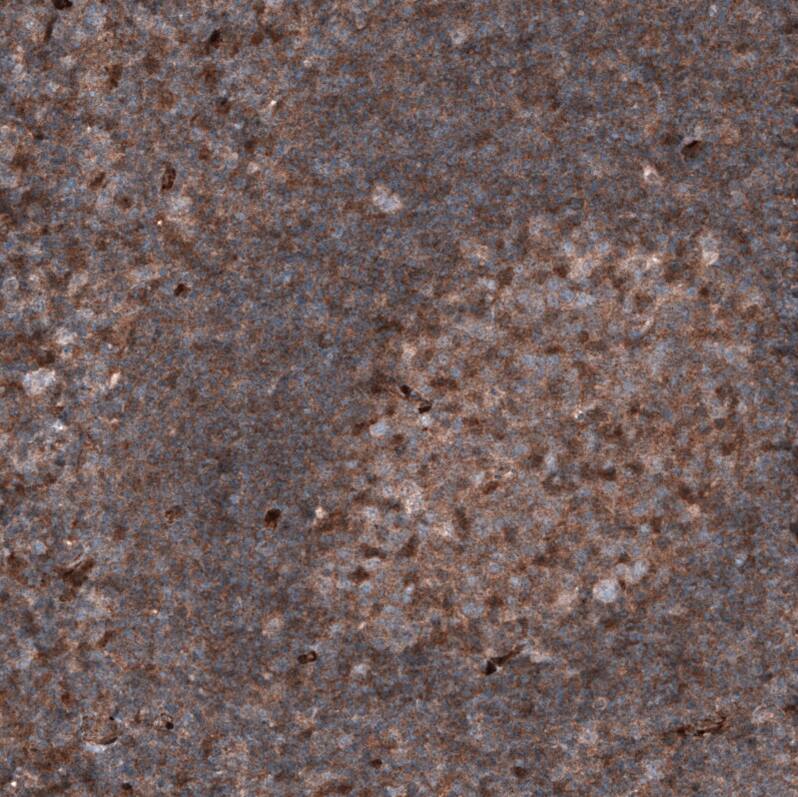 Staining of human tonsil shows moderate to strong cytoplasmic positivity in germinal center cells.