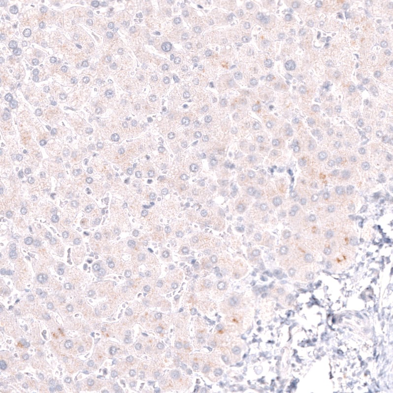 Staining of human liver shows no nuclear positivity in hepatocytes as expected.