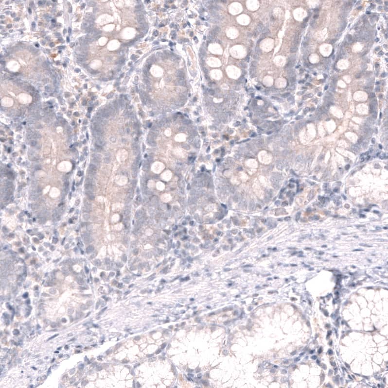 <b>Orthogonal Strategies Validation. </b>Staining of human duodenum shows no positivity in glandular cells as expected.