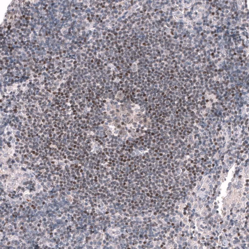 Staining of human lymph node shows weak to moderate nuclear positivity in lymphoid cells.