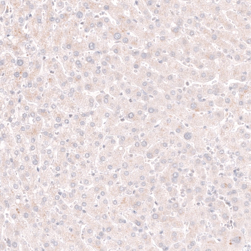 Staining of human liver shows no nuclear positivity in hepatocytes as expected.