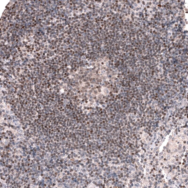 Staining of human lymph node shows weak to moderate nuclear positivity in lymphoid cells.