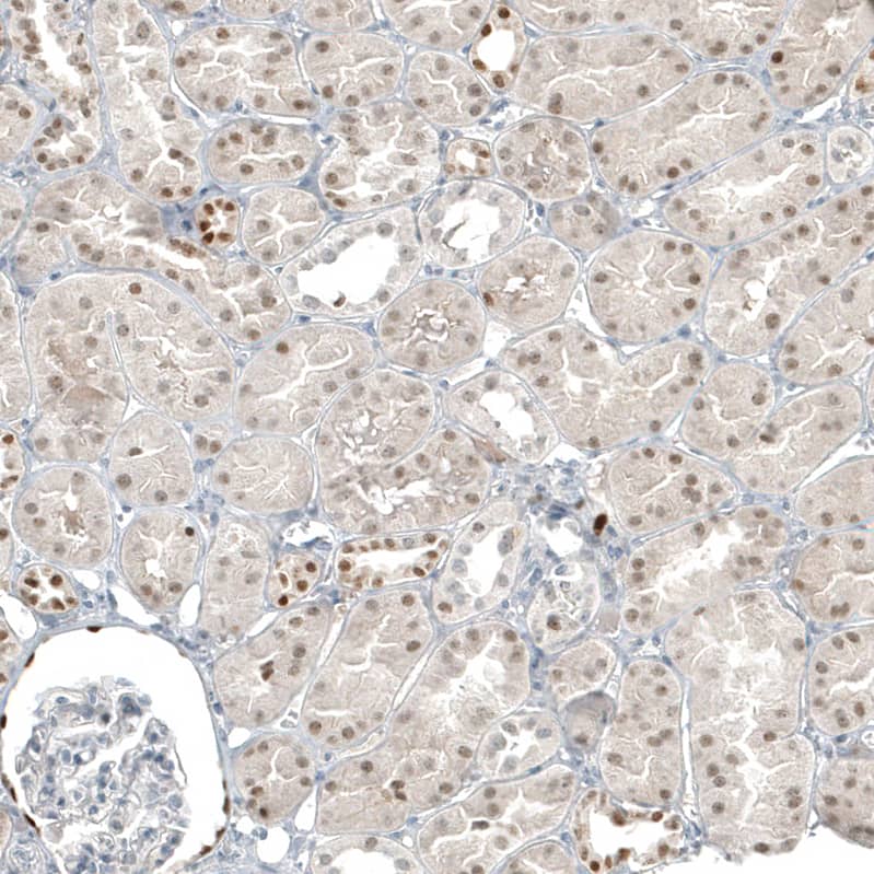 Staining of human kidney shows weak to moderate nuclear positivity in cells in tubules.
