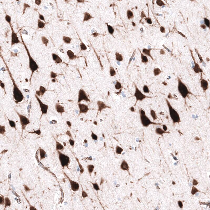 Staining of human cerebral cortex shows strong cytoplasmic positivity in neurons.