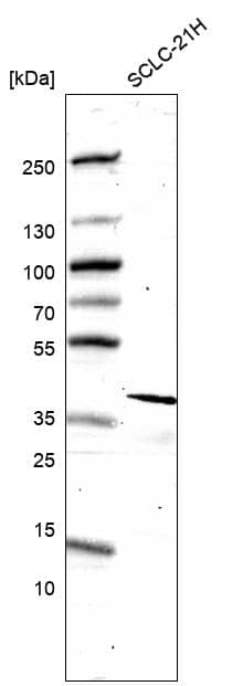 Analysis in human cell line SCLC-21H.