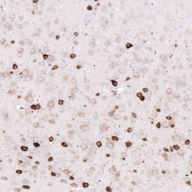 Staining of mouse cerebral cortex shows strong cytoplasmic positivity in neurons.