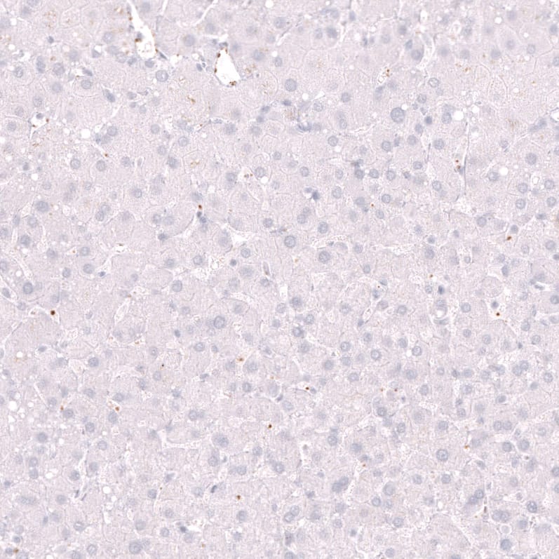 Staining of human liver shows no positivity in hepatocytes as expected.