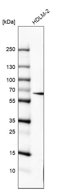 Analysis in human cell line HDLM-2.