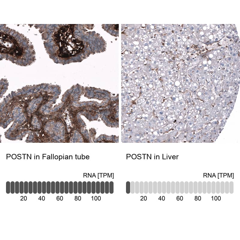 <b>Orthogonal Strategies Validation. </b>Analysis in human fallopian tube and liver tissues using NBP3-44324 antibody. Corresponding Periostin/OSF-2 RNA-seq data are presented for the same tissues.