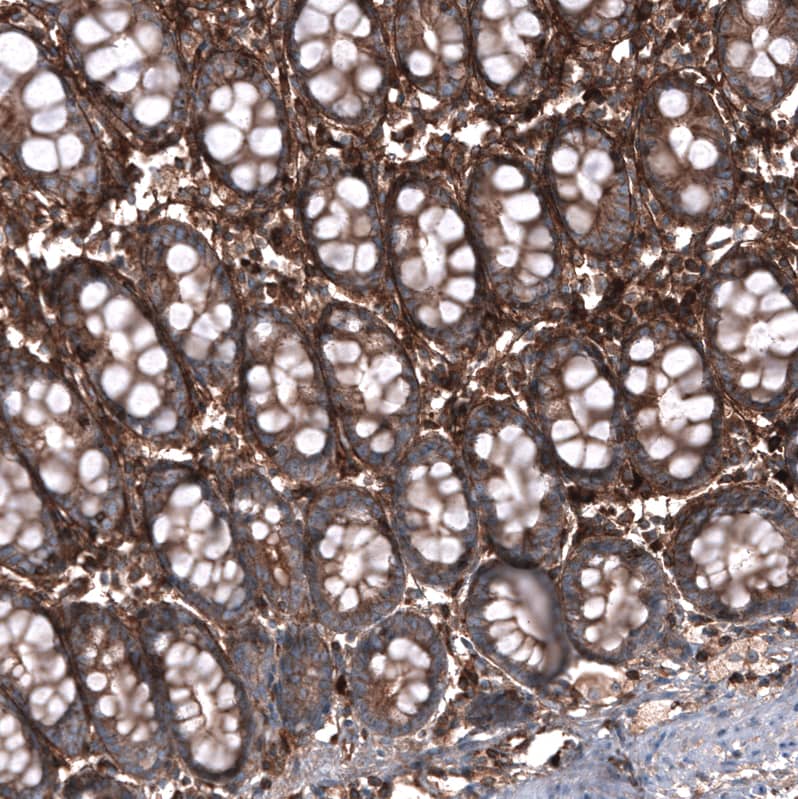Staining of human colon shows strong positivity in extracellular matrix, as well as moderate positivity in glandular cells.