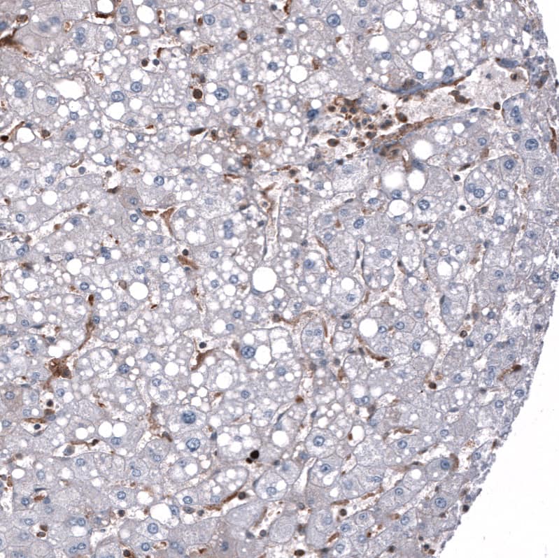 Staining of human liver shows no positivity in hepatocytes as expected.