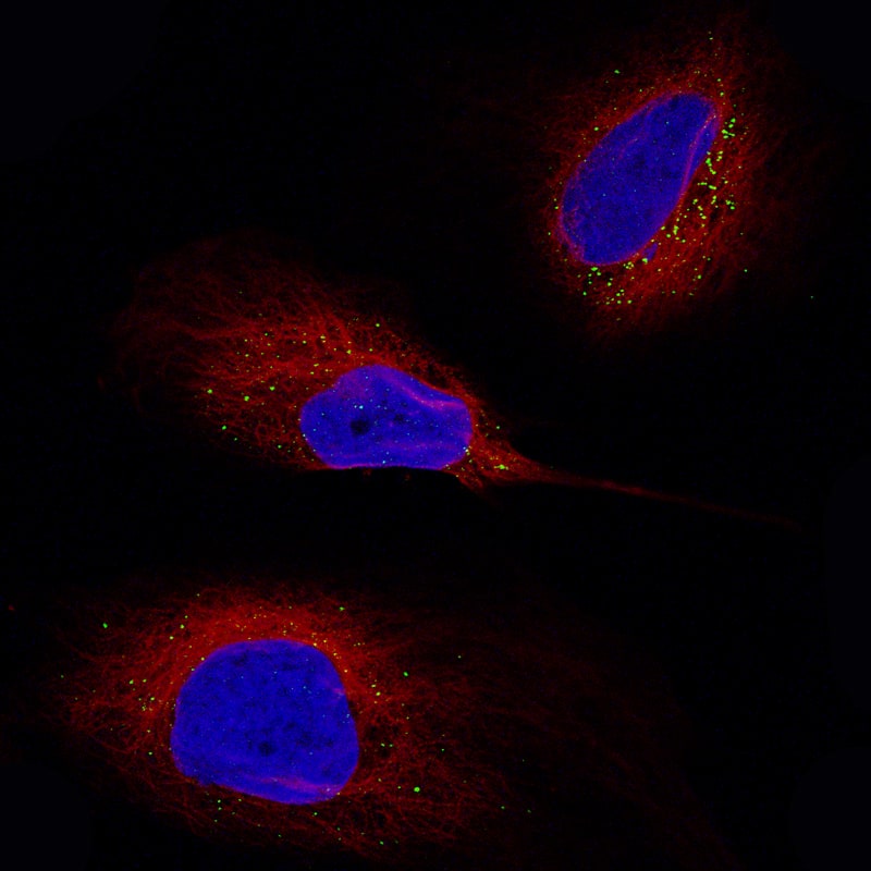 Staining of U-138 cells using the Anti-Periostin/OSF-2 monoclonal antibody, showing specific staining in vesicles in green. Microtubule- and nuclear probes are visualized in red and blue, respectively. 