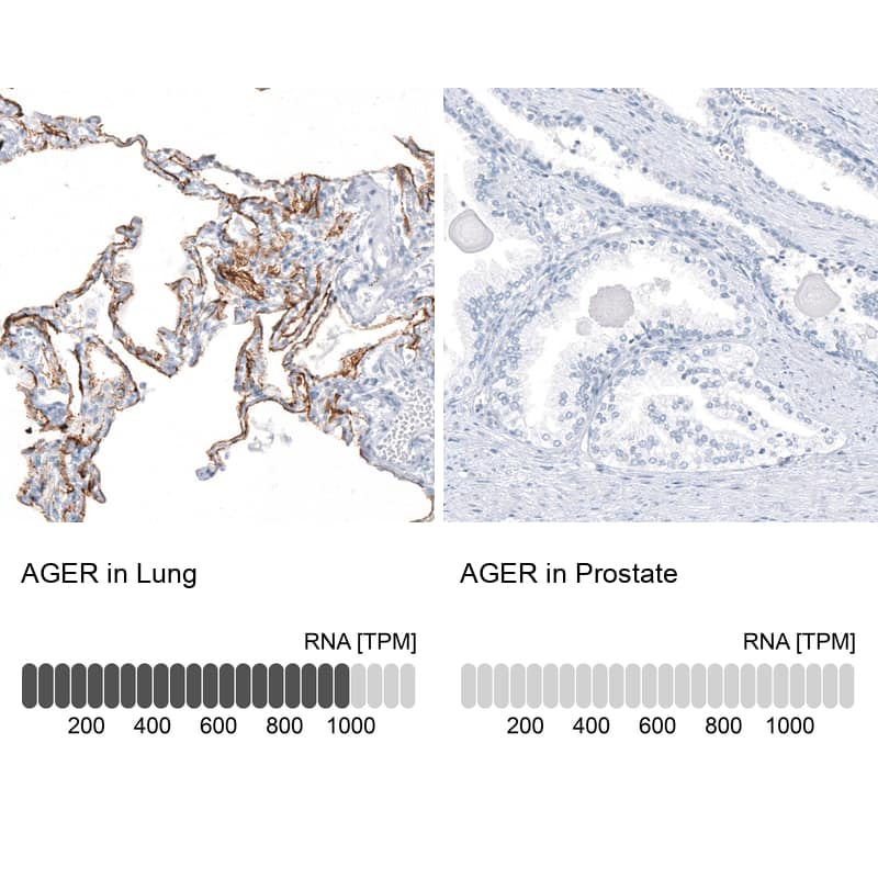 Analysis in human lung and prostate tissues using NBP3-44325 antibody. Corresponding AGER RNA-seq data are presented for the same tissues.