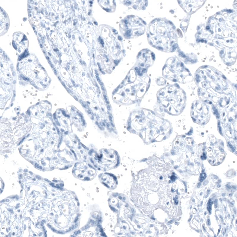 Staining of human placenta shows no positivity in trophoblastic cells as expected.