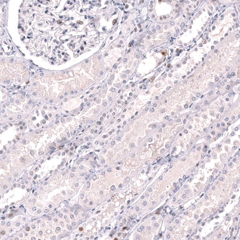 Staining of human kidney shows mainly absence of positivity in cells in tubules as expected.