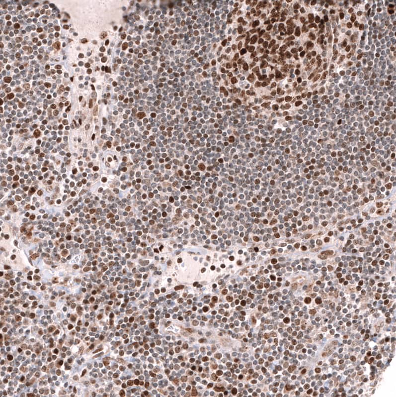 Staining of human lymph node shows moderate to strong nuclear positivity in lymphoid cells.