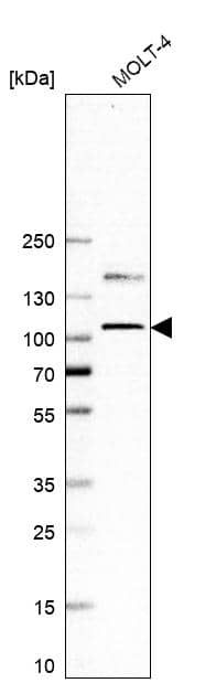 Analysis in human cell line MOLT-4.