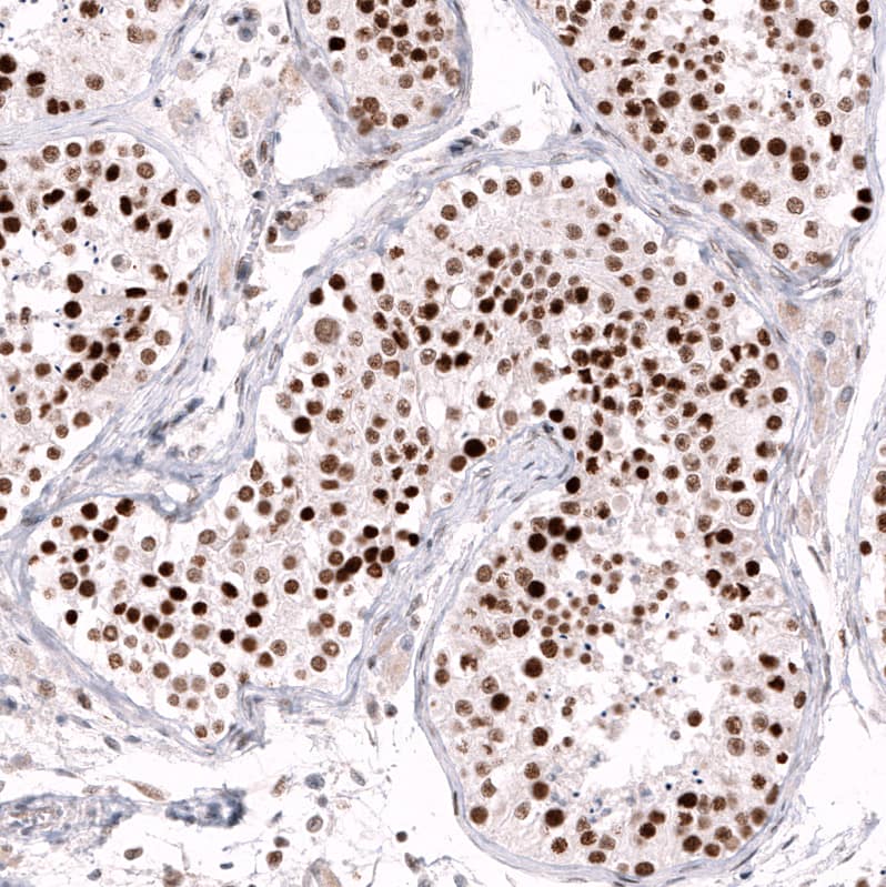 Staining of human testis shows strong nuclear positivity in cells in seminiferous ducts.