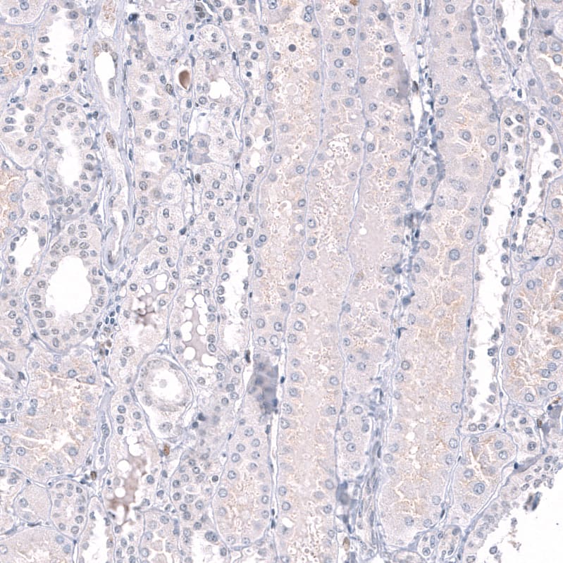Staining of human kidney shows no positivity in cells in tubules as expected.