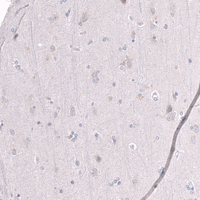 Staining of human cerebral cortex shows no positivity in neurons as expected.