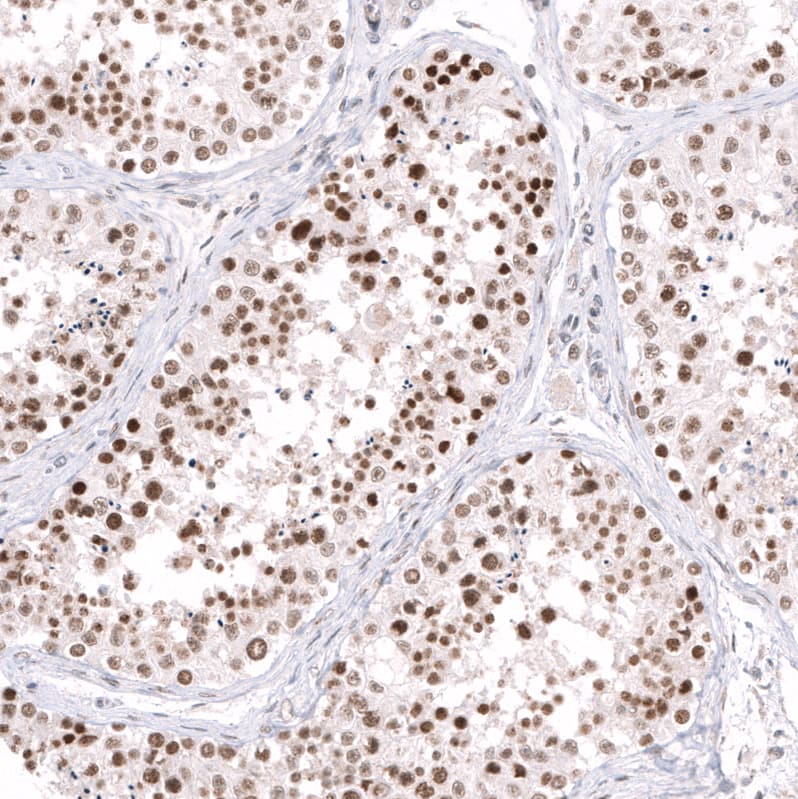 Staining of human testis shows moderate to strong nuclear positivity in cells in seminiferous ducts.
