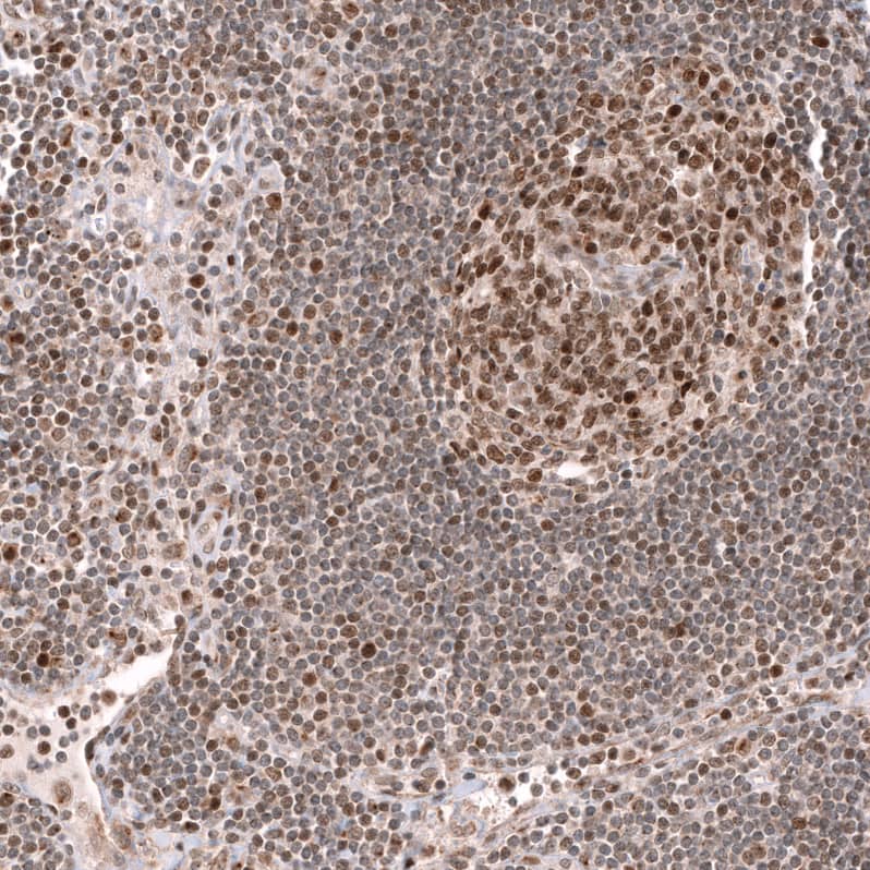 Staining of human lymph node shows moderate to strong nuclear positivity in lymphoid cells.