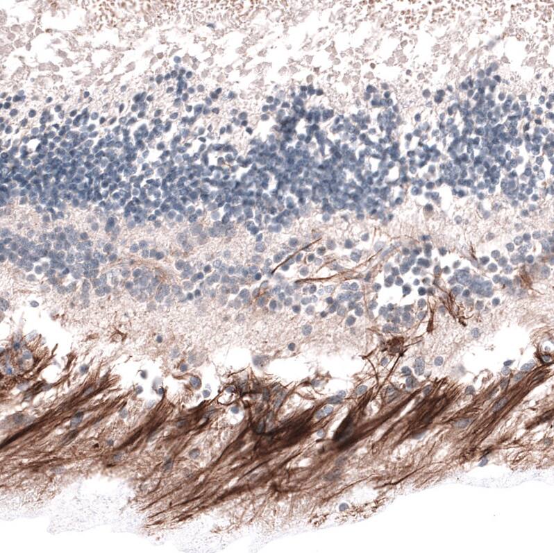 Staining of human eye retina shows strong positivity in the nerve fiber layer.