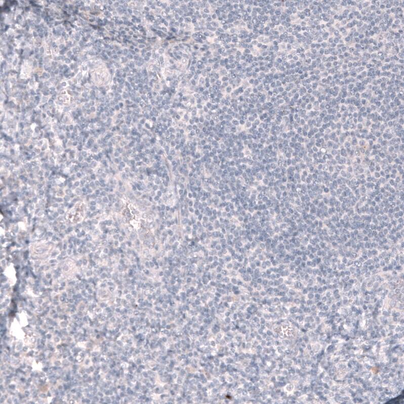 Staining of human tonsil shows no positivity in lymphoid cells as expected.