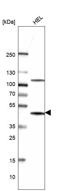 Analysis in human cell line HEL.
