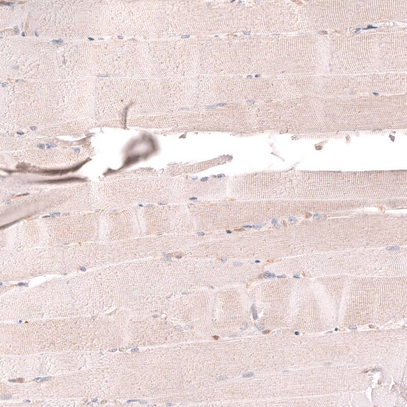 Staining of human skeletal muscle shows no positivity in myocytes as expected.