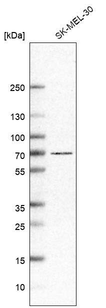 Analysis in human cell line SK-MEL-30.