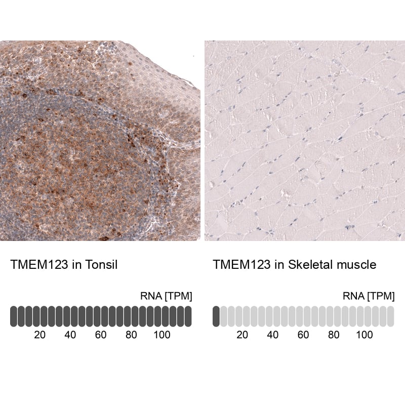 Analysis in human tonsil and skeletal muscle tissues using NBP3-44335 antibody. Corresponding Porimin RNA-seq data are presented for the same tissues.
