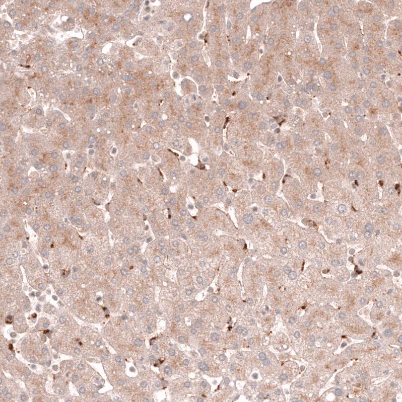 Staining of human liver shows moderate cytoplasmic positivity in hepatocytes.