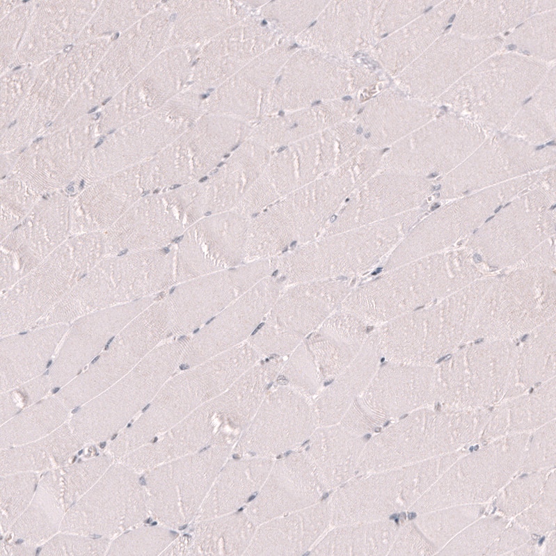 Staining of human skeletal muscle shows no positivity in myocytes as expected.